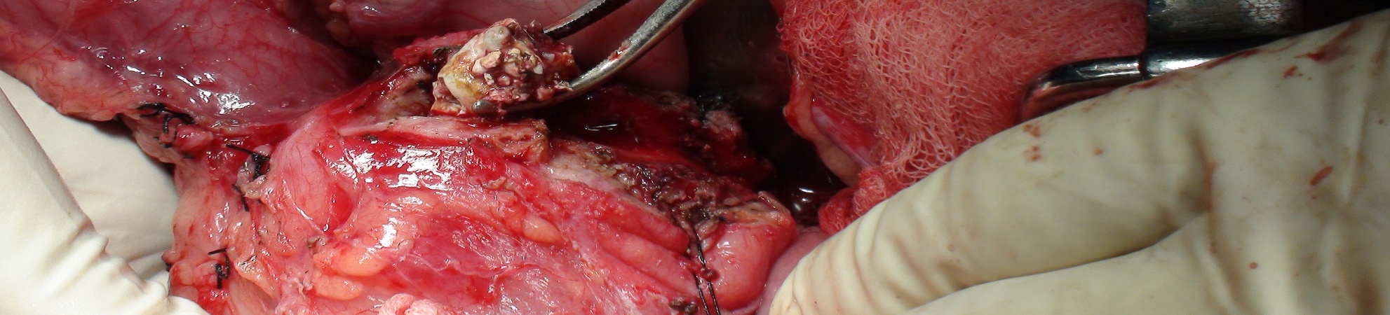 Operative Moments Operative Moments